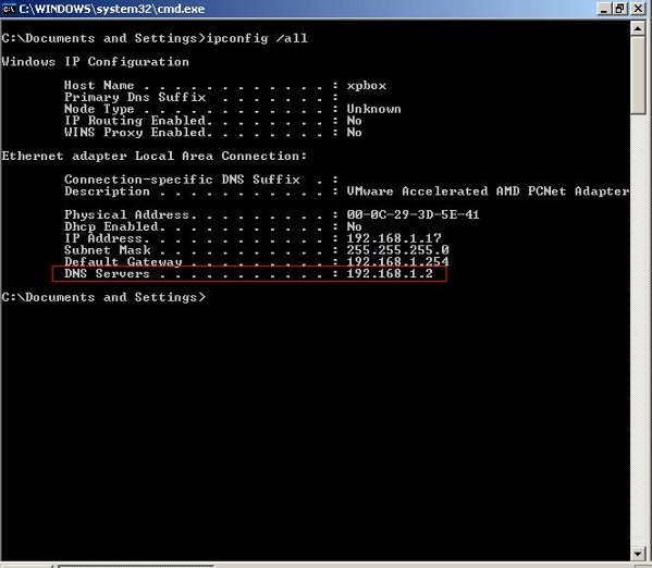 Vista Command Line Network Settings